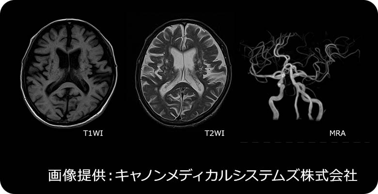 MRI画像 | 画像提供：キヤノンメディカルシステムズ株式会社
